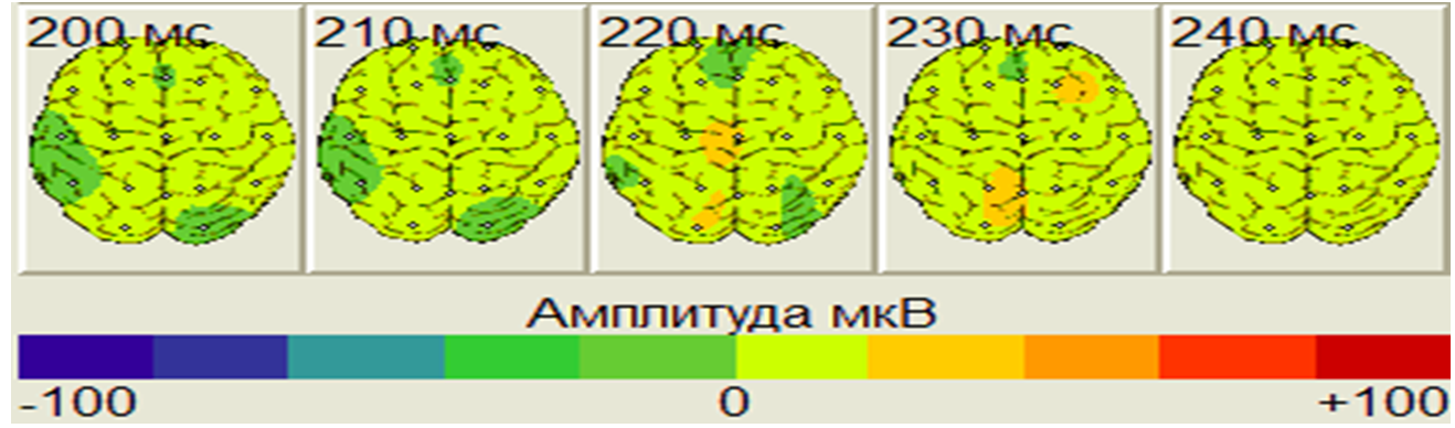 Топографические карты ЭЭГ